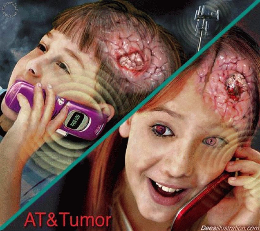 AT&Tumor ("American Telephone & Telegraph", devenu "American Telephone & Tu-meurs") - par David Dees